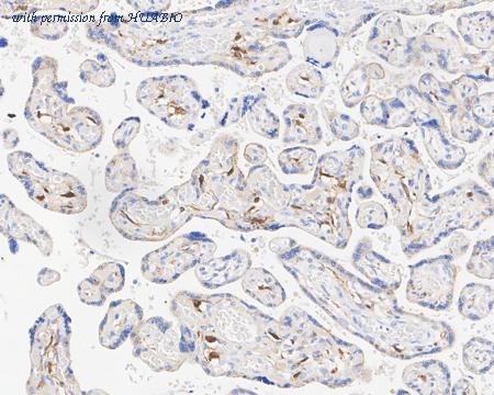 HUABIO HA721645 image 3