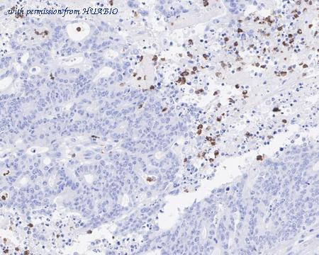 HUABIO HA721686 image 1