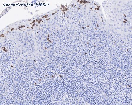 HUABIO HA721686 image 2