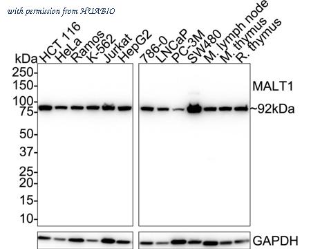 HUABIO HA721689 image 1