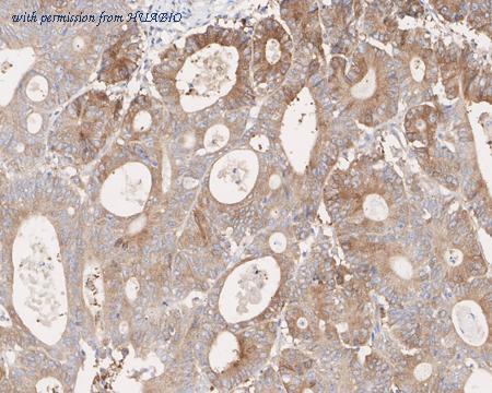 HUABIO HA721689 image 2