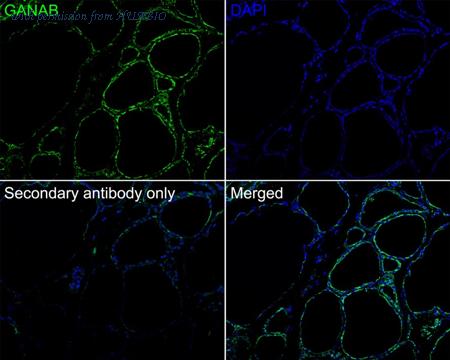 HUABIO HA721695 image 2