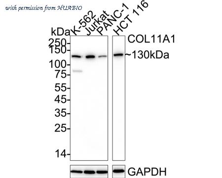 HUABIO HA721718 image 1