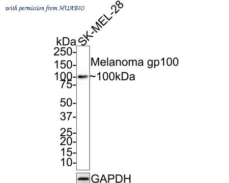 HUABIO HA721719 image 1