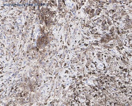 HUABIO HA721719 image 2