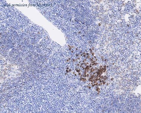 HUABIO HA721724 image 2