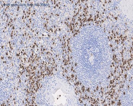 HUABIO HA721725 image 1