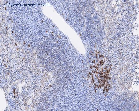 HUABIO HA721725 image 2