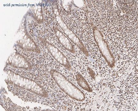 HUABIO HA721726 image 1