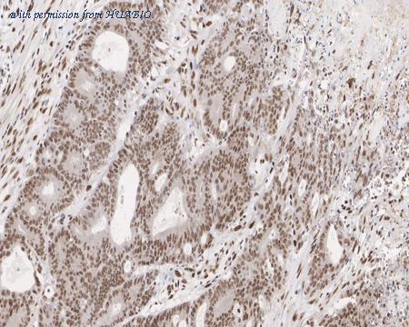 HUABIO HA721726 image 2