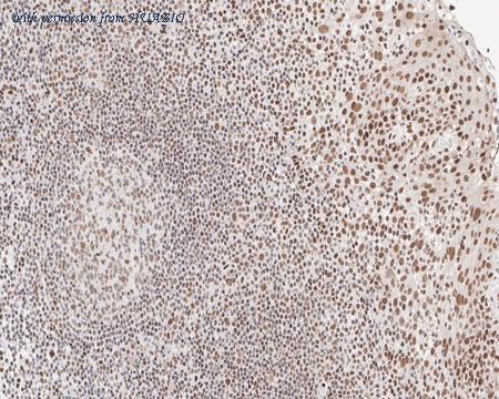 HUABIO HA721726 image 3