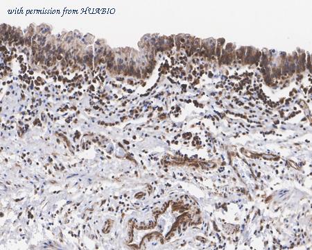 HUABIO HA721748 image 3