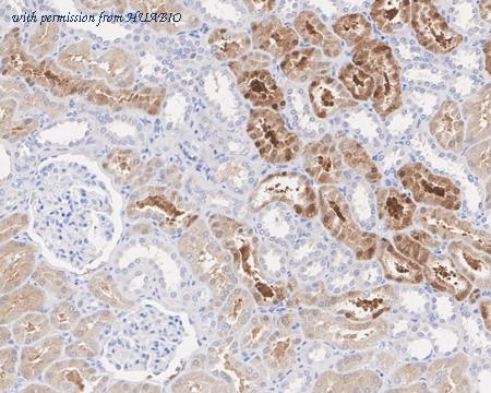 HUABIO HA721763 image 2