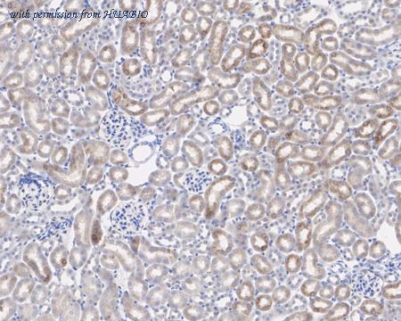 HUABIO HA721763 image 3