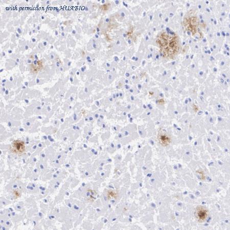 HUABIO HA721789 image 2