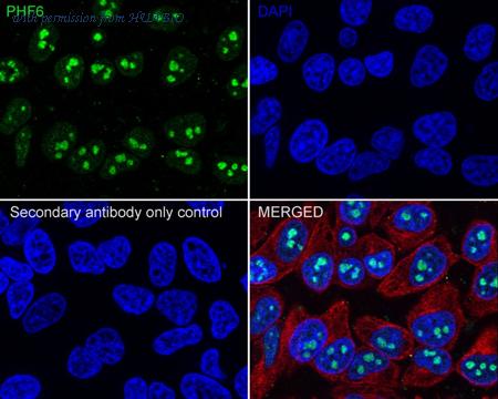 HUABIO HA721812 image 3