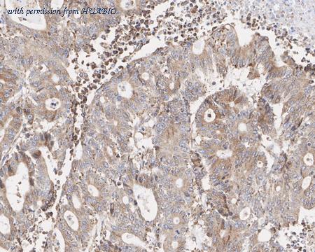 HUABIO HA721813 image 2