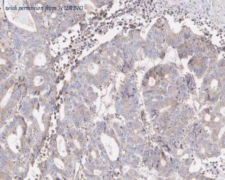 HUABIO HA721814 image 3