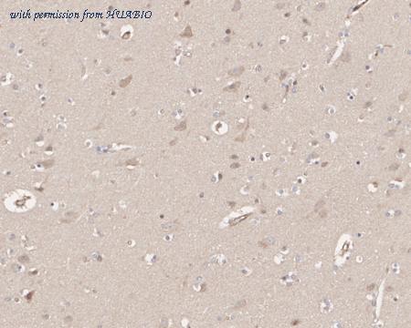 HUABIO HA721815 image 2