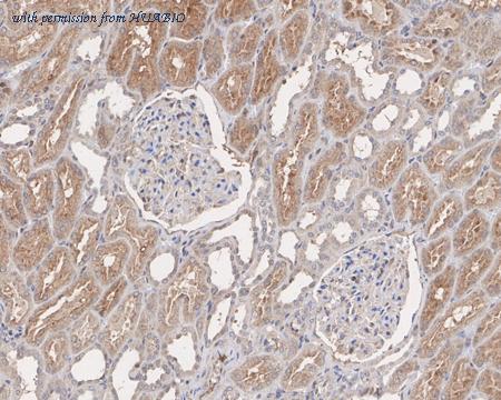 HUABIO HA721815 image 3