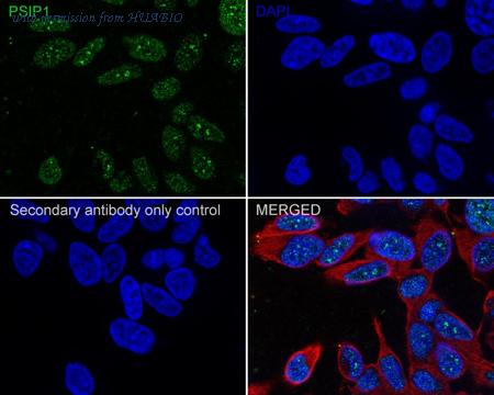 HUABIO HA721831 image 2