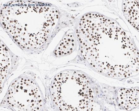 HUABIO HA721831 image 3