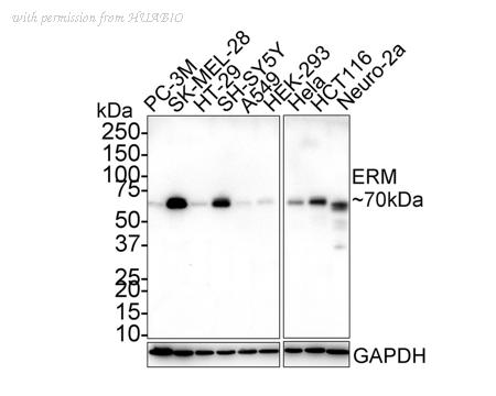 HUABIO HA721842 image 1