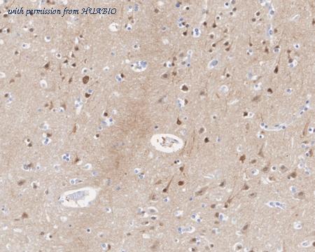 HUABIO HA721842 image 2