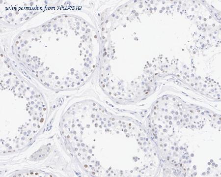 HUABIO HA721842 image 3