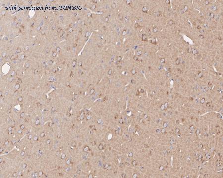 HUABIO HA721843 image 3