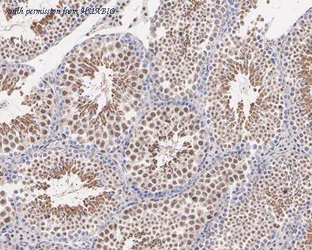 HUABIO HA721844 image 3