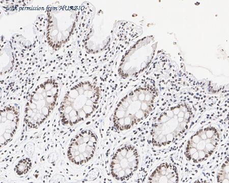 HUABIO HA721855 image 2