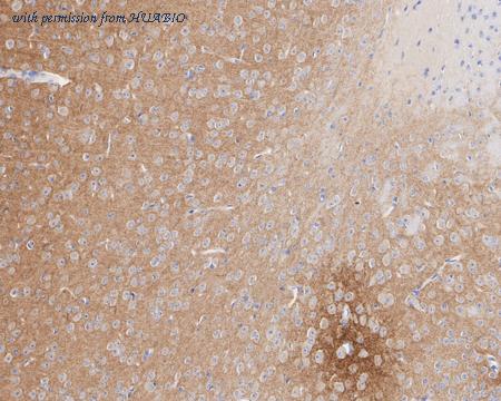 HUABIO HA721860 image 2