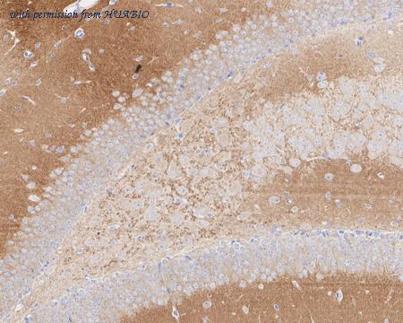 HUABIO HA721860 image 3