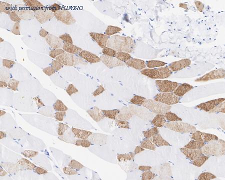 HUABIO HA721862 image 3