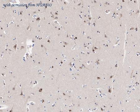 HUABIO HA721882 image 2