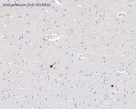 HUABIO HA721891 image 3