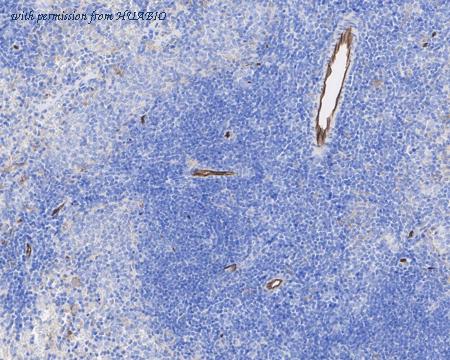 HUABIO HA721893 image 3