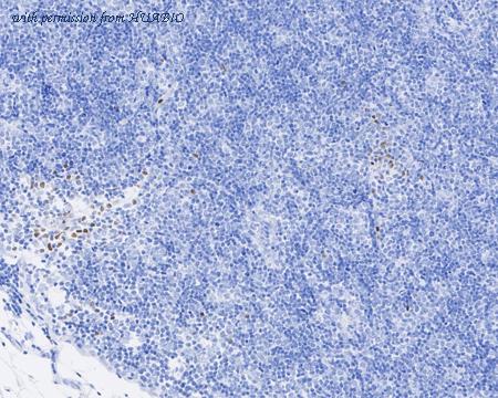 HUABIO HA721901 image 3