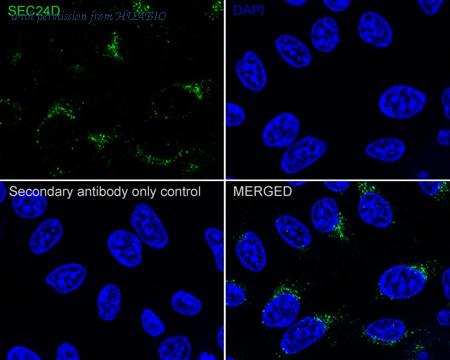 HUABIO HA721902 image 3