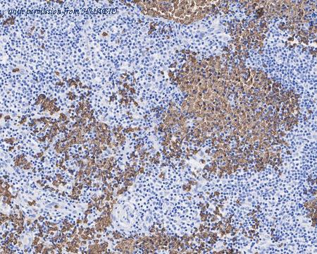 HUABIO HA721920 image 2