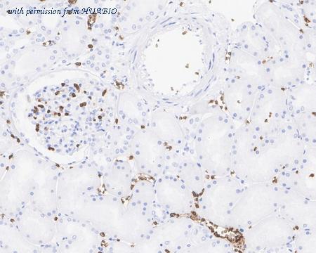 HUABIO HA721920 image 3