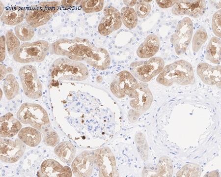 HUABIO HA721924 image 3