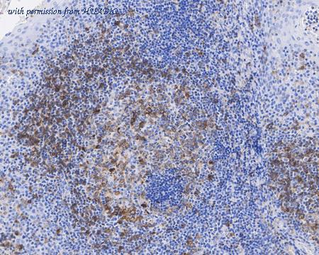 HUABIO HA721927 image 2