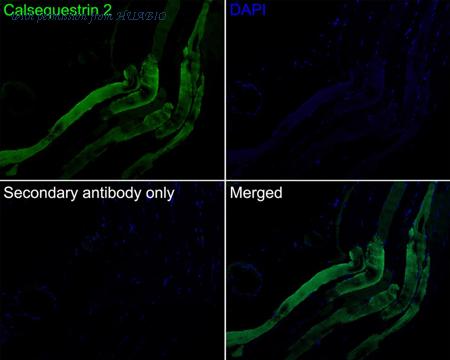 HUABIO HA721944 image 2