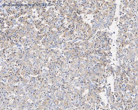 HUABIO HA721959 image 3