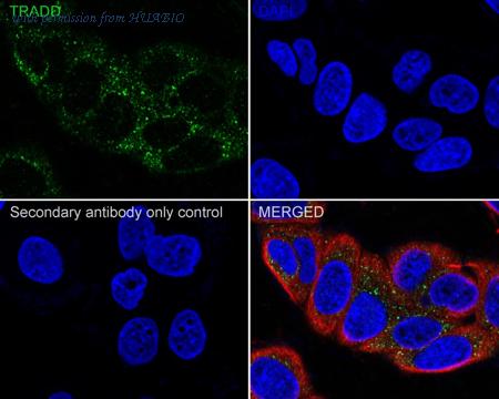 HUABIO HA722000 image 3