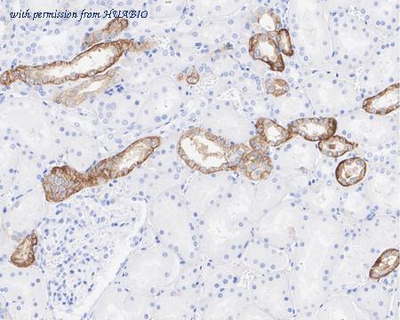 HUABIO HA722006 image 2