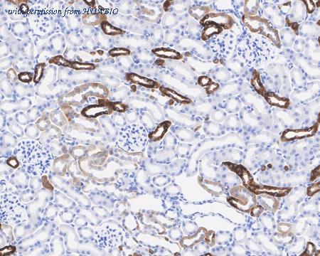 HUABIO HA722006 image 3