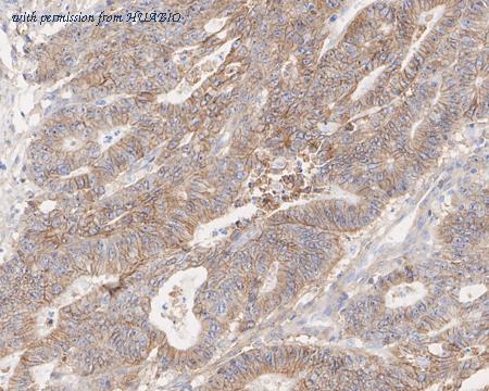 HUABIO HA722007 image 3